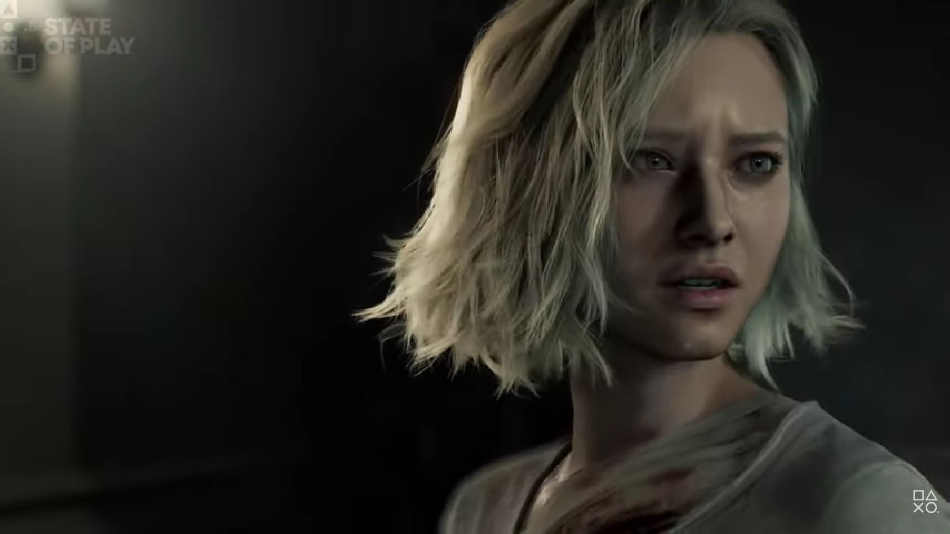 article-thumbnail-260213d