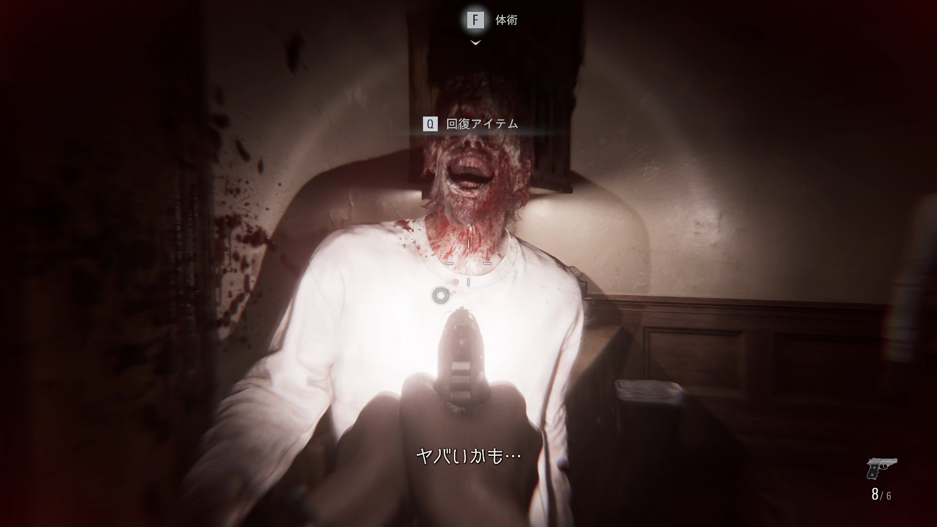 【バイオ9】『バイオハザード レクイエム』をプレイしてみたら「“弾一発”を撃つか撃たないか」みたいな判断ひとつで明暗がわかれる、本当に遊びたい『サバイバルホラー』になっていた_015